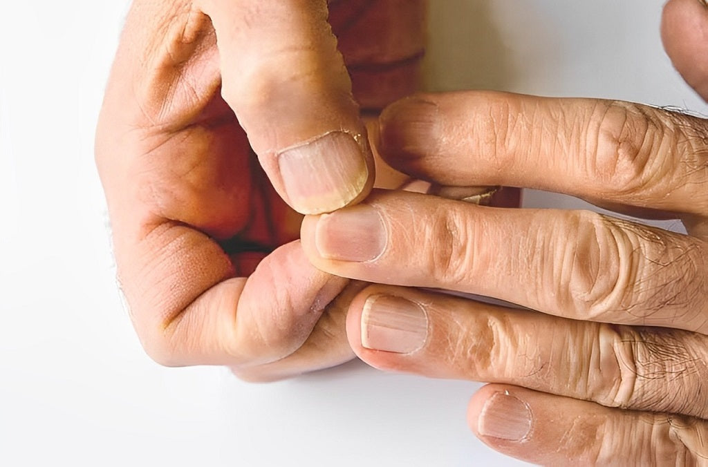 Spoon Nails